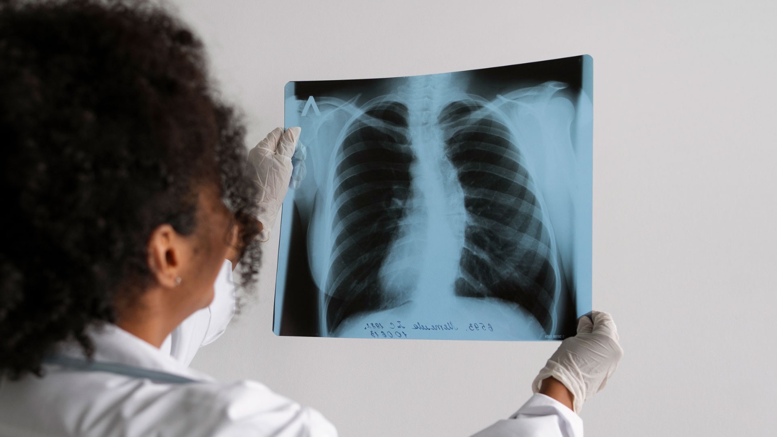 Imagen muestra a doctora detectando cáncer de pulmón